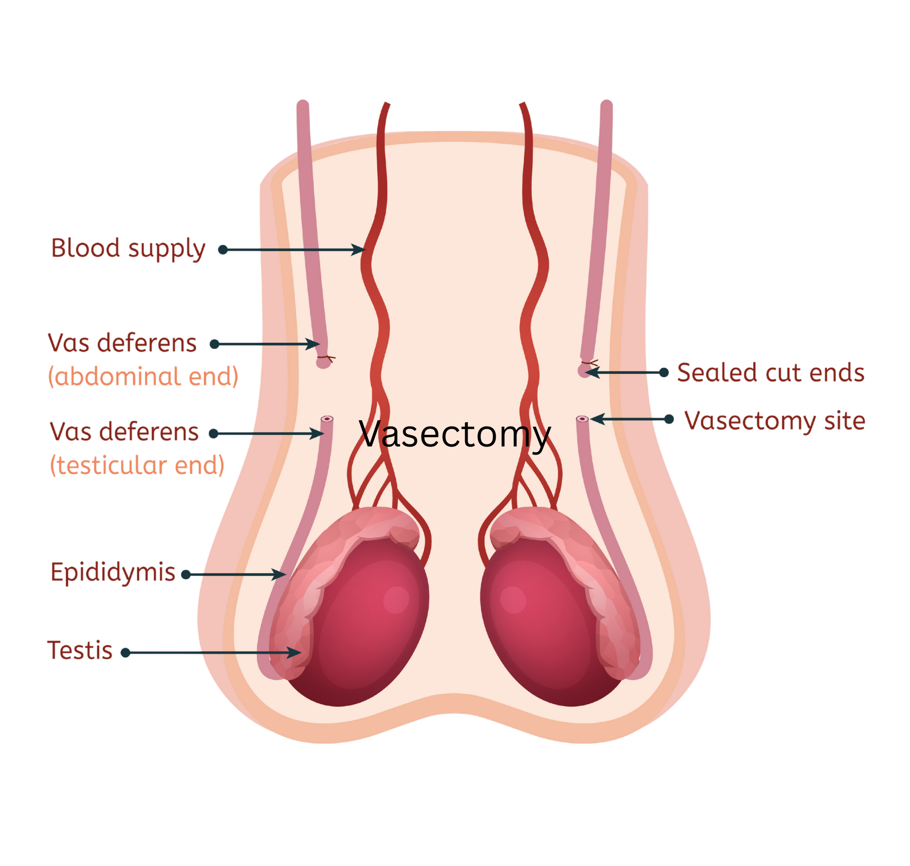 Vasectomy and male anatomy