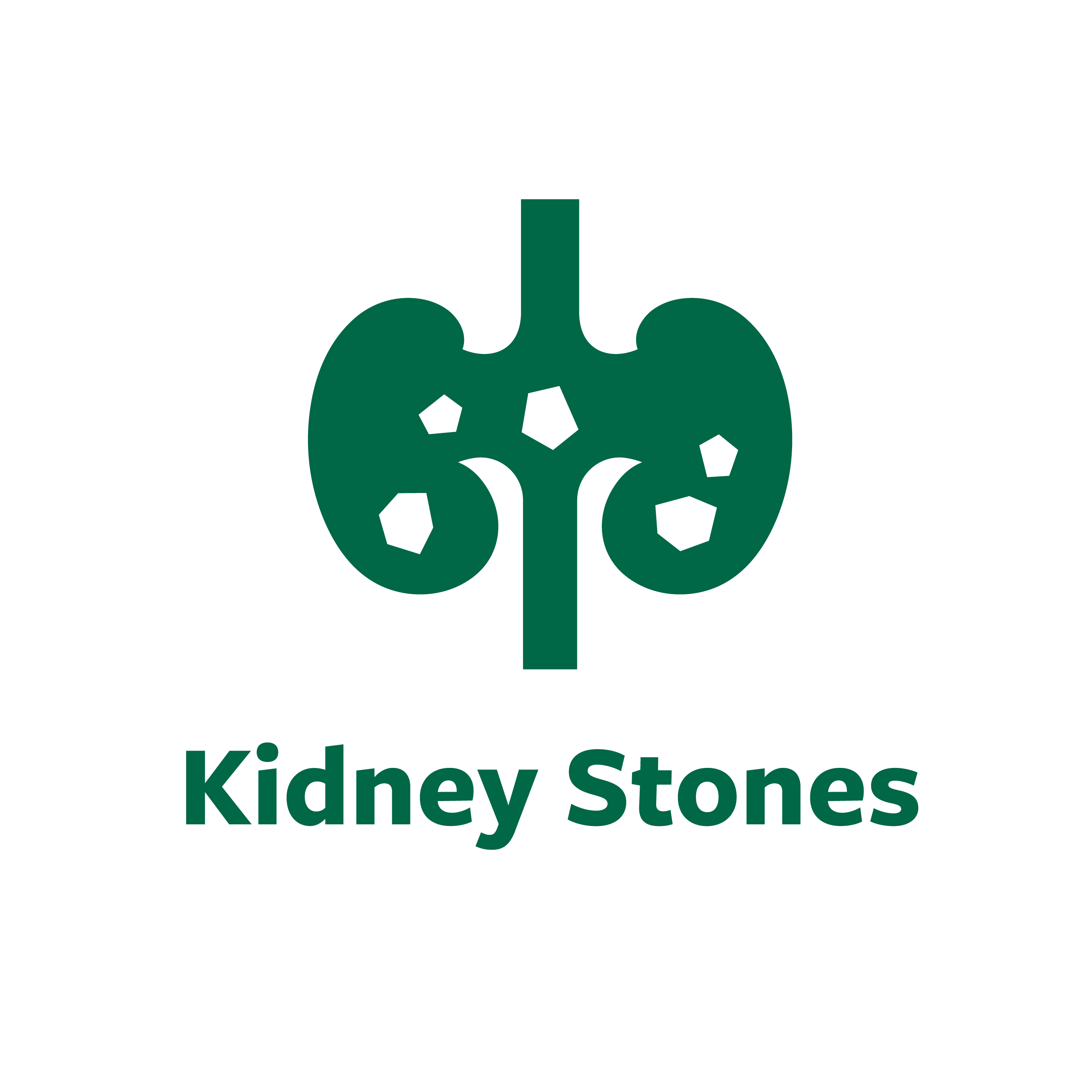 Treat Kidney Stones